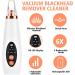 Sxdthy 3 Levels Adjustable Suction Blackhead Remover USB Rechargeable Blackhead Pore Cleaner Blackhead Suction Tool with HD LED Display & 6 Replaceable Heads - Buy Online on GoSupps.com