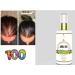 Organic Amla Oil for Hair Growth - 100% Pure Indian Gooseberry Scalp Treatment | Cold Pressed, Virgin & Unrefined Alma Oil - Revitalize & Promote Hair Growth with Therapeutic Grade Formula - Buy Online on GoSupps.com