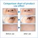 Hyalu B5 Serum Hyaluronic Acid B5 Serum Anti Aging Serum Face Serum Concentrate Hyaluronic Acid Serum for Face - Anti Aging Instant Face Firming & Plumping Face Fade Fine Lines 30ml - Buy Online on GoSupps.com