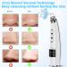 2022 Upgraded Blackhead Remover Pore Vacuum - Electric Facial Cleaner for Acne, Whiteheads - 5 Suction Power, 5 Probes - USB Rechargeable Kit for Women & Men - Buy Online on GoSupps.com