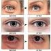 Under Eye Collagen Treatment Mask with Aloe Vera - Brighten, Reduce Wrinkles, Dark Circles, Eye Bags & Puffiness - 30 Pairs - Buy Online on GoSupps.com