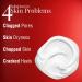 ELMORE 42% Glycerine Cream - Chamomile Extract Moisturizing for Chapped Skin & Cracked Heels | Fragrance-Free Glycerin Hand Cream - Fast-Absorbing Formula - Buy Online on GoSupps.com