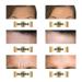Forehead Wrinkle Patches - Anti-Wrinkle Pads for Smoother Skin | 10 Pcs - Buy Online on GoSupps.com