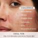 Oil Control Face Wash for Oily Skin & Acne | Deep Cleanser for Men & Women | 100 ml - International Shipping Available - Buy Online on GoSupps.com