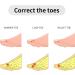 Skisneostype Hammer Toe Splints - 10 Pcs Fabric Toe Splint for Correcting Hammer, Broken, Crooked, and Overlapping Toes - Buy Online on GoSupps.com
