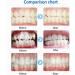 Dental Mouth Opener - Silicone Cheek Retractor for Dentistry - Blue 1PCS | International Shipping Available - Buy Online on GoSupps.com