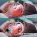 2023 Deepnite Snoreless Microdevice - Smart Snore Stopper & Nasal Congestion Respirator - Buy Online on GoSupps.com