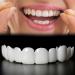 Achieve Your Perfect Smile! Adjustable Smile Support Kit - 2 Pairs for Upper & Lower