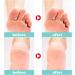 TBeautfave Urea Foot Cream 40% Urea Cream Callus Remover For Dry And Hard Skin Cracked Heel Repair Cream Deep Moisturizing Feet Cream Nourishes Soften for Feet Elbows Knees - Buy Online on GoSupps.com