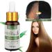 Natural Hair Growth Serum - Anti-Hair Loss & Thickening | Herbal Essence for Thinner Hair (30 ml) - Buy Online on GoSupps.com