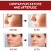 Aibyks 2 Skin Tag Corrector | Natural Mole Remover Cream Natural Skin Tag Removal Mole Corrector for Face Wart and Body Wart - Buy Online on GoSupps.com