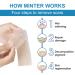 MT Healthy Silicone Scar Removal Sheets - 6 Pcs (5.9 x 1.6 inches) - 3 Months Supply - Reusable & Washable - Comfortable & Painless - For Hypertrophic Scars and Keloids - Buy Online on GoSupps.com