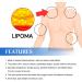 LUFFREE Lipom Distance Cream - Natural Ointment to Remove Lipomas | 3 Piece Set - Buy Online on GoSupps.com