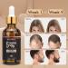 5% Minoxidil & Biotin Hair Growth Serum - 60ML for Men and Women | Hair Regrowth Treatment for Thicker, Longer, Healthier Hair | Prevent Scalp Hair Loss | Natural Formula for Fuller Hair - Buy Online on GoSupps.com