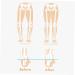 Buy Correcting Insoles for Supination & Heel Pain - Cushioned Shoe Inserts for Sports & Everyday Comfort - International Shipping Available - Buy Online on GoSupps.com