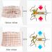 Fbite Back Support Belt - Lumbar Traction & Decompression for Sciatica Relief | Abdominal Bandage for Men & Women - Buy Online on GoSupps.com