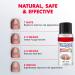 Extra Strong Fungal Nail Treatment 20ml - Premium Toenail and Fingernail Fungus Eliminator - Anti-Fungal Repair and Strengthening - 1 PCS - Buy Online on GoSupps.com