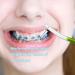 Orthodontic Toothbrush Set - Double Ended Ortho Brush for Braces, V-Trim & Interspace Brush - 5 Pack - Buy Online on GoSupps.com