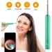 DOITOOL 8Pcs Silicone Ear Cleaner Tips - Replacement Ear Spoon Heads for Bebird Ear Wax Removal Camera - Buy Online on GoSupps.com
