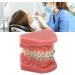 Typodont Orthodontic Tooth Model (28 Teeth) - Realistic Crowded Teeth & Malocclusion Representation for Dental Education & Practice - Buy Online on GoSupps.com