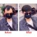 Hairline Toupee for Men Frontal Hairpiece Forehead Toupee V-shape Natural 100% Human Hair with Pu Thin Skin Covering Male Receding - Buy Online on GoSupps.com