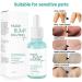 CeFoney Skin Dent Ingrown Hair Prevention Serum - Razor Bump & After Shave Solution (30ml) - Buy Online on GoSupps.com