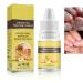 Tbeautfave Fungal Nail Treatment Nail Fungus Treatment for Toenail Ginseng Nail Treatment Essence Nail Growth Treatment Relief Oil Nail Repair Solution Toenail Oil Treatment Nail Care