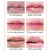 Hydrating Lip Mask Set | Reduce Lip Wrinkles & Improve Lip Lines | Attractive & Sexy Lips - Buy Online on GoSupps.com