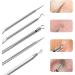 Usiveinborn Blackhead Remover Usiveinborn Tweezers Usiveinborn Professional Facial Blackhead Remover Tweezers Teppeic Tweezers Blackheads (4Pcs A) - Buy Online on GoSupps.com