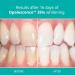 Opalescence 35% Teeth Whitening Gel Syringes - 4 Pack Mint Flavor - Buy Online on GoSupps.com