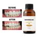Groomarang Gum Oil - 100% Pure Botanical Oils (Extra Strength) | 15ml Pack of 2 for Healthy Skin & Hair - Buy Online on GoSupps.com