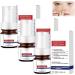 Aobenz Serum Aobenz Whitening and Freckle Removing Essence Aobenz Anti-Spot Serum Aobenz Spot Remover Serum Aobenz Dark Spot Correcting Serum Aobenz Spot Remover for Face Wrinkle Power(3pc)