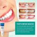 sjfscqr Probiotic Fast Whitening Toothpaste Ultra Whitening Toothpaste for Fresh Breath SP-4 Whitening and Stain Removal Toothpaste - Buy Online on GoSupps.com
