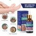 Nail Fungus Treatment - Toenail Fungus Repair Solution - 1oz Home Treatment (1 PCS) - Buy Online on GoSupps.com