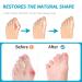 Hammer Toe Straightener & Corrector - Multi-Size Toe Spacers for Curled Toes Bunions & Crooked Toes (For Men & Women - Buy Online on GoSupps.com