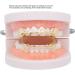 Hip Hop Brace Party Teeth Brace Compatible for Halloween for Party for Music Concerts(Gold) - Buy Online on GoSupps.com