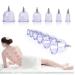 BDSM KIT Cupping set with pump 25 20 9 12 pieces of transparent chinese cupping massage therapy set in different sizes-wrinkle reducers and anti-embarking device UK