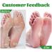 Heel Repair and Moisturizing Cream Fast Absorbing Repair and Moisturizing Dry Feet Foot Repair and Moisturizing Cream Healing Ointment for Cracked Heels - Buy Online on GoSupps.com