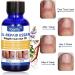 Nail Repair Natural Nail Care Maximum Strength Nail Solution Restores Discolored & Damaged Nails Nail Care Solution - Buy Online on GoSupps.com