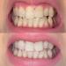 Buy CMIIL High-Quality PAP Teeth Whitening Strips - 14 Treatments Peroxide-Free Gentle on Enamel 28 Stripes for Sensitive Teeth - Buy Online on GoSupps.com