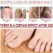 Lot de 2 huiles allemandes anti-paronychia pour ongles des pieds et des orteils endommag s et d color s - Buy Online on GoSupps.com