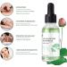 Essential Lotus Leaf Oil for Weight Loss | Herbal Massage Oil | 15ml Cellulite Treatment | Perfect Shape (5 Pack) - Buy Online on GoSupps.com