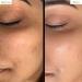 Buy PUB Avocado & Licorice Melt Exfoliating Foaming Cleanser | Daily Face Cleanser for Normal to Oily Skin | Deep Cleansing & Oil Removal - 100ml - Buy Online on GoSupps.com