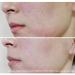 Buy BONAJOUR Vegan Cica Repair Serum - Acne Scar Remover | Extreme Repair Ampoule for Acne-Prone Skin | 13g - International Shipping Available - Buy Online on GoSupps.com