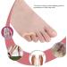 10 Pcs Gel Little Toe Buddy Toe Corrector & Straightener for Tailor's Bunion Pain Relief - Buy Online on GoSupps.com