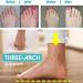Bunion Sandals Orthopedic Toe Corrector Sandals - Purple 9 - Buy Online on GoSupps.com