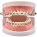 RZJZGZ Orthodontic Ligature Ties O-Rings Braces Rubber Bands (1040pcs) - Multicolor - Buy Online on GoSupps.com