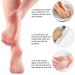 Pedicure Foot File & Heel Scraper | Professional Hard Skin Remover for Dry Cracked Feet - Buy Online on GoSupps.com