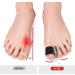 6 Pairs Unisex Toe Separator - Pain Relief & Toe Alignment Aid for Bunions, Hammer Toes - Elastic & Comfortable Material for Men and Women - Buy Online on GoSupps.com