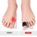 Bunion Corrector Toe Spacers - Professional Flexible Separators for Men (6 Pairs) - Buy Online on GoSupps.com